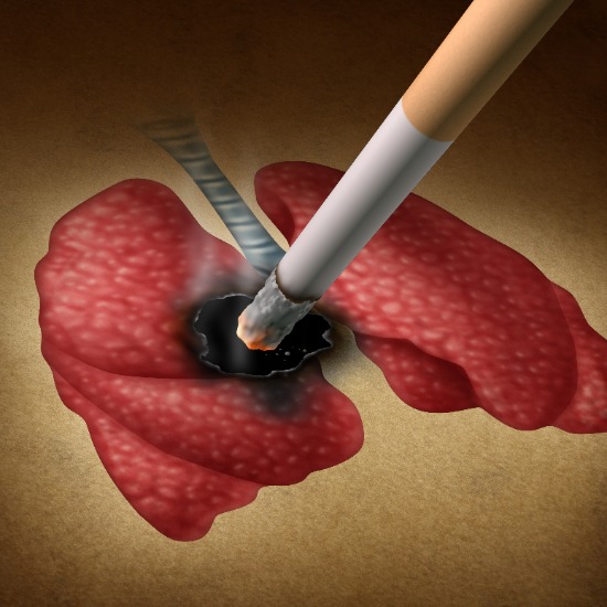 COPD stoppen met roken